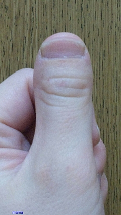 横に平べったい親指の爪 | ママの交流掲示板 | ママスタコミュニティ